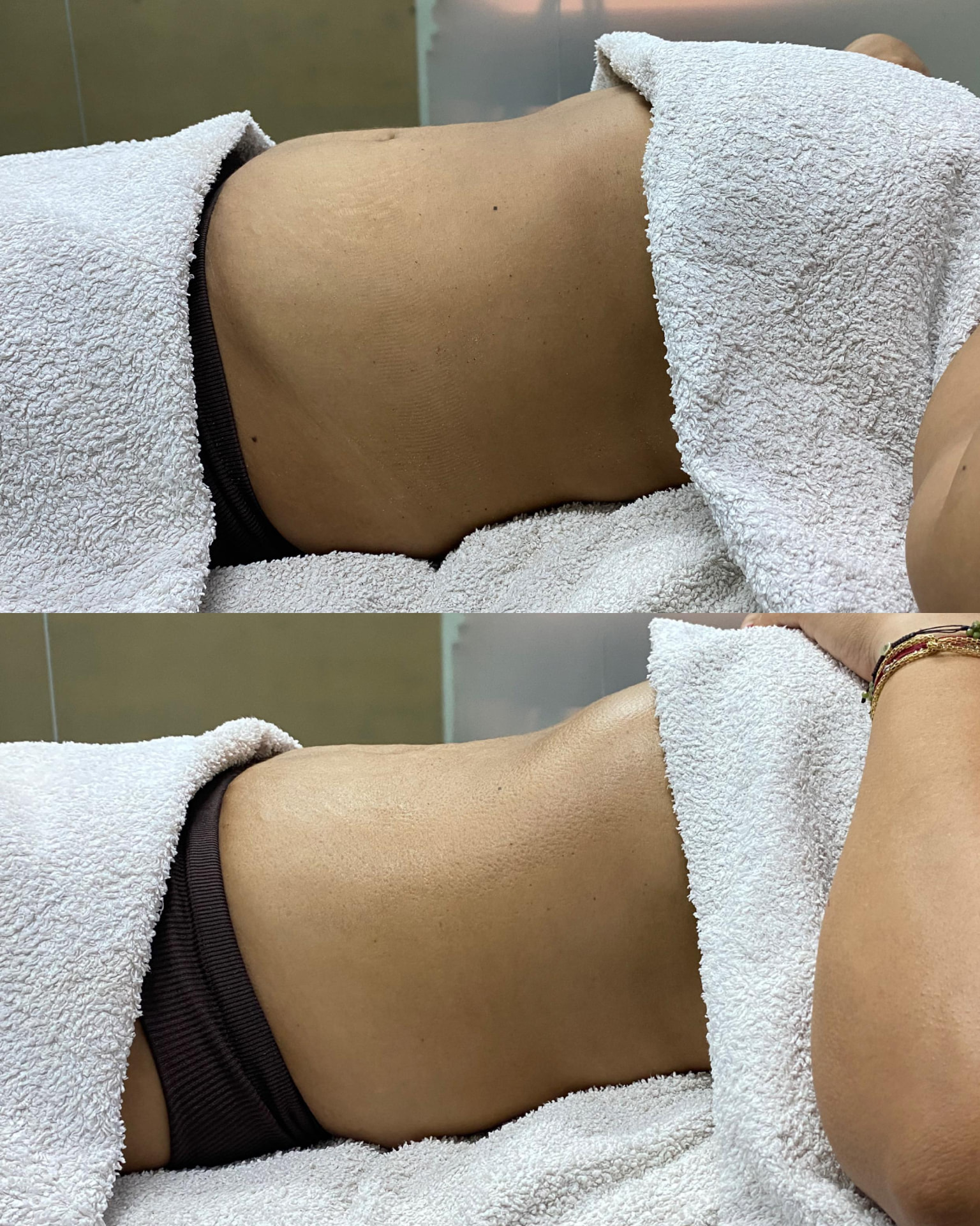 Resultado 02: comparação antes e depois do Protocolo RESET